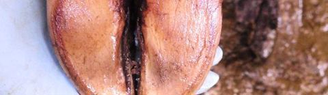 Arthrite de l’articulation du doigt provoquée par un abcès : notez le gonflement du pied du côté de l’onglon externe. Malgré la talonnette pour soulager l’onglon, pour cet animal, il est trop tard.N.Gaudout